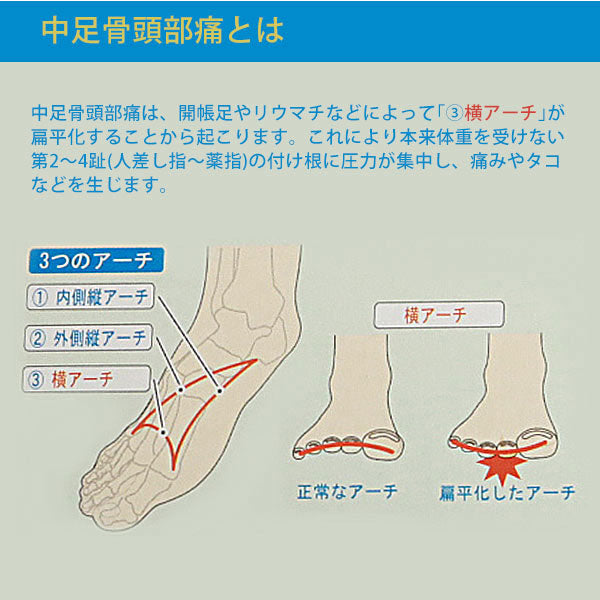ノーブランド No Brand インソールプロ insole PRO 中足骨頭部痛対策 インソール【返品不可商品】